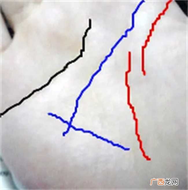 生命线中断手相图解大怎