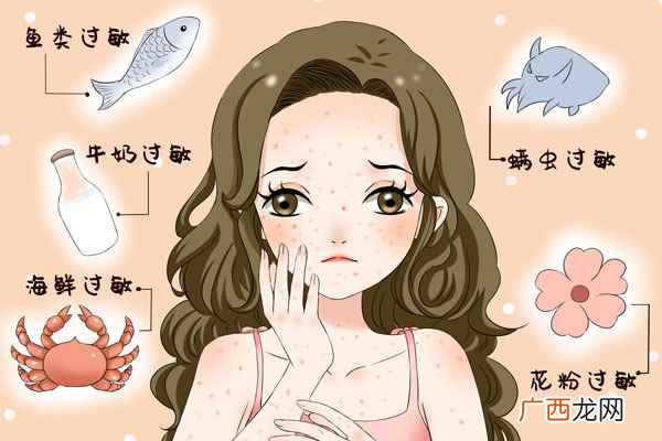 海鲜过敏症状