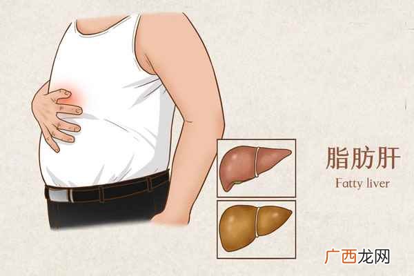 脂肪肝吃什么好