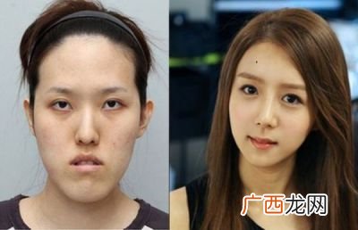 韩国人都整容吗,为什么韩国男生脸型长得都很立体？