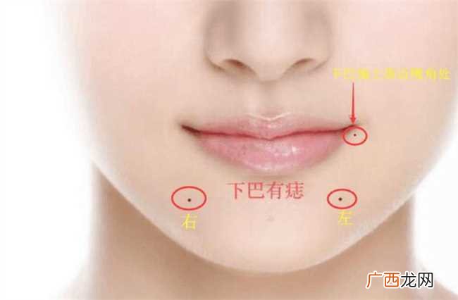穷人痣在哪里 发际线痣前途坎坷