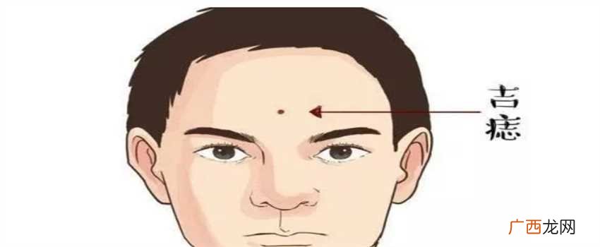 额上痣，眉毛痣，下眼痣 男痣的位置与命运图总论