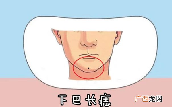 右下巴和右下巴有痣最有福气 下巴的痣长在哪里最好