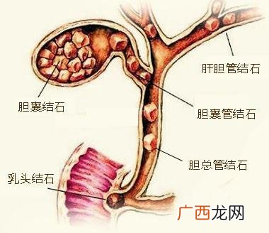 胆对人体有什么作用,胆在身体什么位置呢？