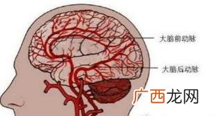 脑供血不足怎么治疗,脑供血不足吃什么药治疗？