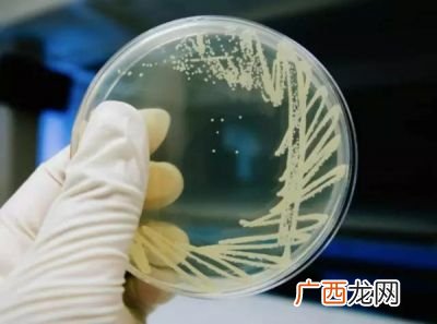 鉴定真菌用什么培养基,PDA培养基属于何种类型？