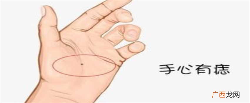 左手掌心有痣什么意思一个人有掌心痣 代表前缘未尽 掌心痣代表什么寓意
