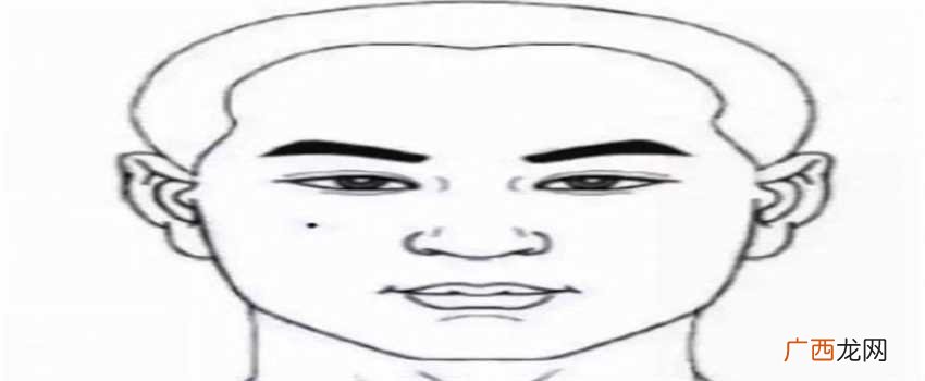 颧骨痣，鼻梁痣，人中痣 泄漏人体隐私的三处面痣