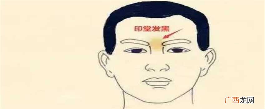 印堂发黑，嘴唇发青，鼻梁出现青筋 几种凶兆来临前的面相