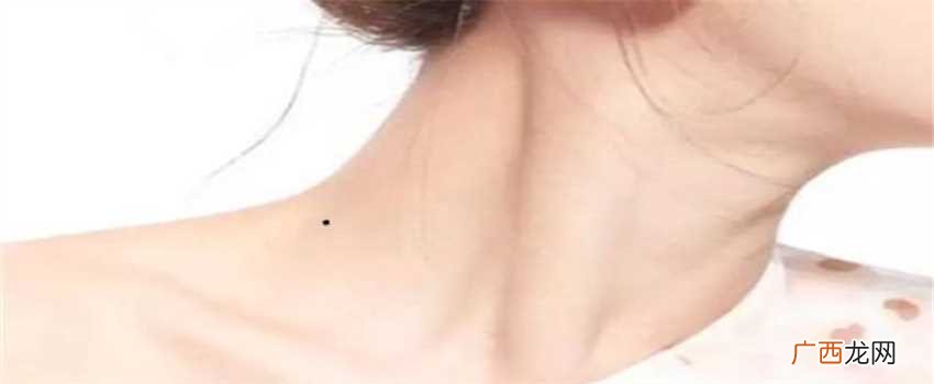 分情况 脖子上长痣面相图：脖子上长痣好不好`
