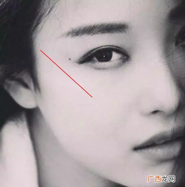 泪痣长在哪里,泪痣和斑的区别?
