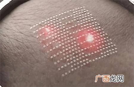 什么是点阵激光,点阵打印机和激光打印机哪个好？