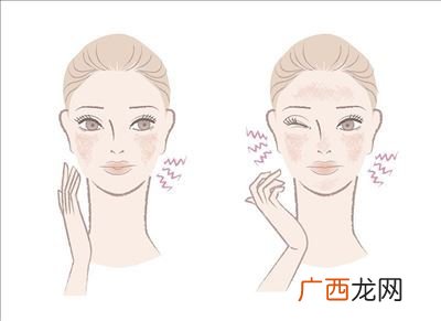 什么是敏感肌,什么是敏感肌和干皮？