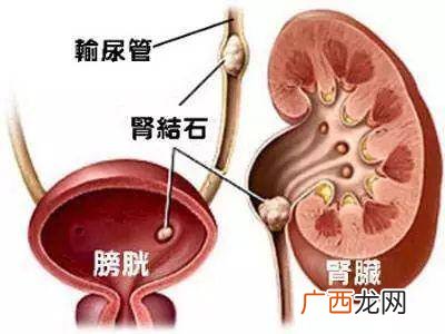 为什么会有肾结石,狗狗为什么会得肾结石？