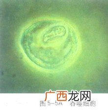 具有吞噬功能的细胞有哪些,人体中负责吞噬病菌的细胞叫什么？