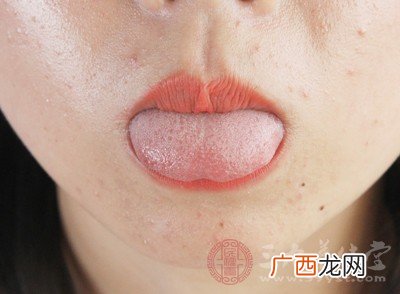 舌头发白是什么原因,舌头发白发黄是什么原因？