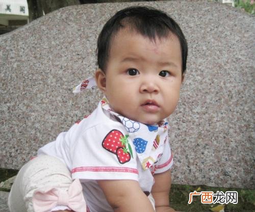 破相是什么意思,真有破相一说吗？