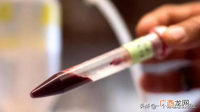 正常人体内有多少血液,人体总血量是多少？