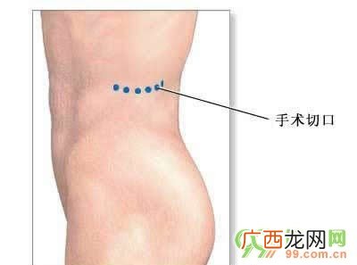 人体肾脏在哪个位置,正常人的肾脏有多大？