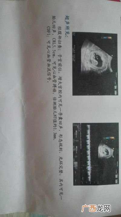 产检nt是检查什么,孕妇检查nt是什么？