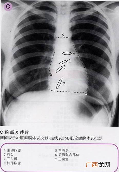 什么心什么肺,什么心什么肺的成语？