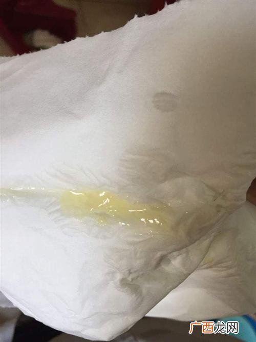 白带发黄是怎么回事,白带发黄，有可能是哪些炎症引起？