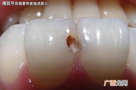梦到掉牙齿是什么预兆,掉虎牙的寓意是什么？