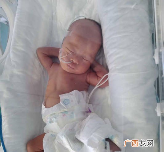 为什么会早产,为什么有的人会早产？