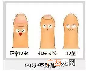 为什么割包皮,割包皮的作用？