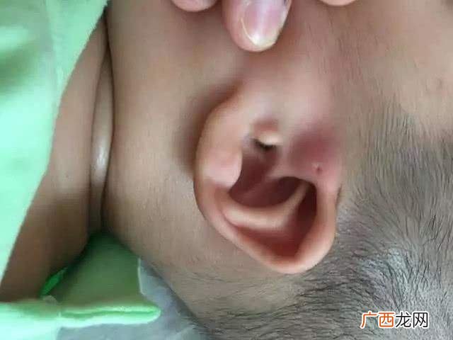 耳朵上面有洞是什么原因,请问，为什么我们家仓鼠耳朵上有个小洞？