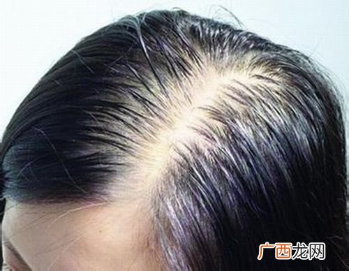 头发属于什么组织,人的头发的构成？