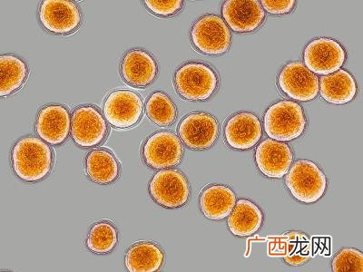 金色葡萄球菌最怕什么,1928年英国细菌学家弗莱明发现了能杀死葡萄除菌的？
