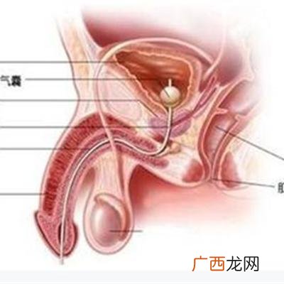 龟头炎怎么办,包皮炎怎么办？