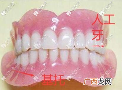 假牙材料哪种好,什么材质的假牙最好？