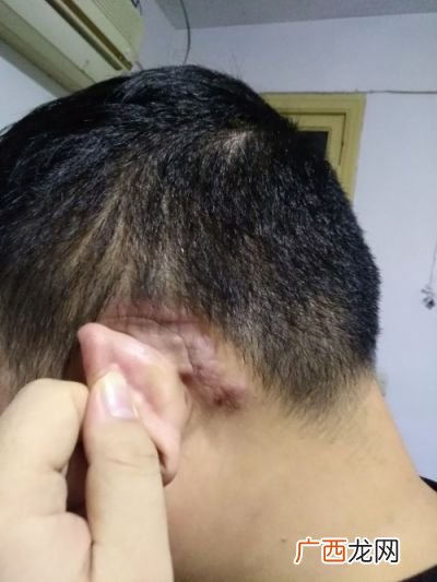 面什么耳什么,成语面什么耳什么？