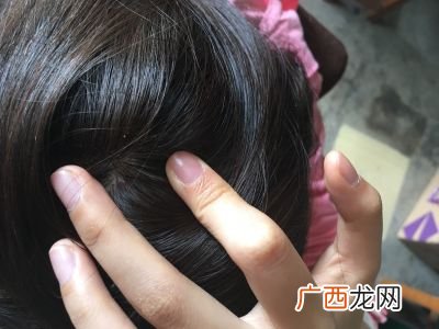 头上长疙瘩怎么处理,头上起疙瘩怎么回事，该如何治疗？
