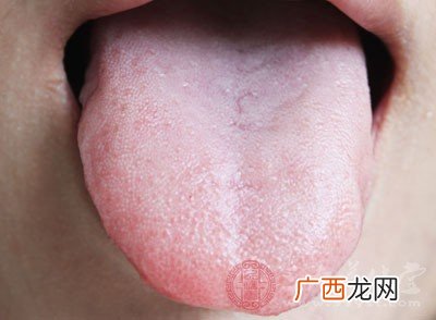 舌苔需要清理吗,二个月婴儿要刷舌头吗？
