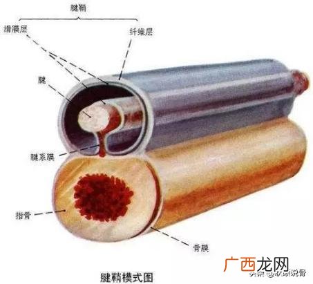 腱鞘炎是什么病,得了腱鞘炎怎么办？