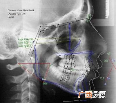 颌面部是哪个位置,脑颅骨的组成？