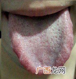 缺乏维生素b12的症状是什么,如何知道缺乏维生素b12？