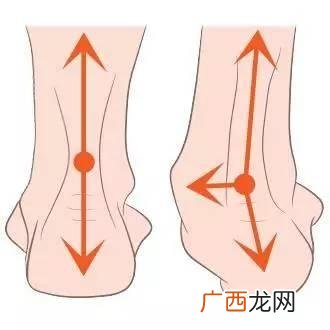 脚后跟疼是什么原因造成的,脚后跟疼是什么原因啊？