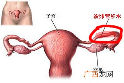 子宫出血是什么病征兆,子宫出血怎么治疗？