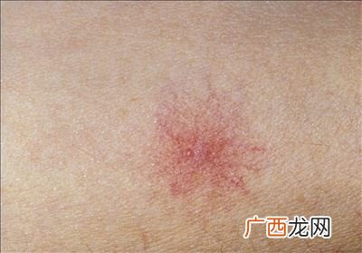 肝功能受损有哪些症状,肝脏有问题的话有什么症状？