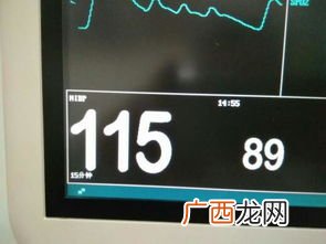 nibp是什么,nibp是什么指标？