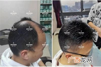 普通假发多少钱,700块钱的假发好吗？