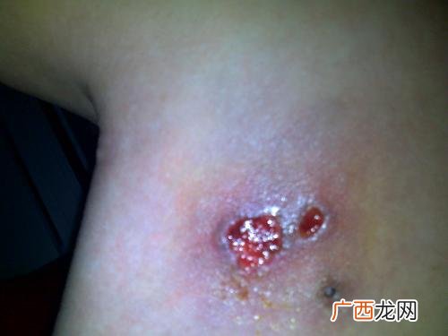 皮肤溃烂化脓怎么办,狗皮肤溃烂化脓用什么药？