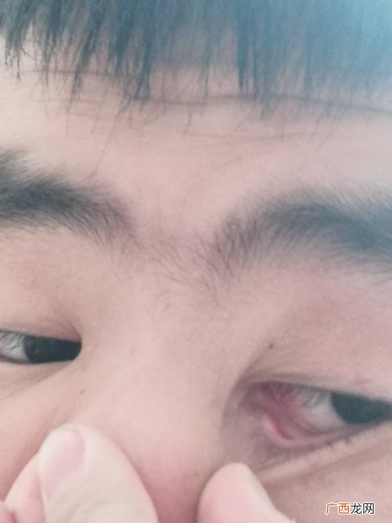 眼睛老是眨眼是什么原因,眼睛眨的频繁是什么原因？