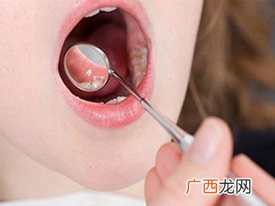 口腔癌早期有什么征兆,口腔癌早期有什么征？