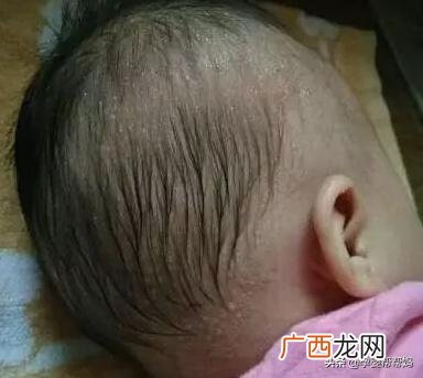 小孩睡觉老出汗是什么原因,小孩一睡觉后背就出汗是什么原因？