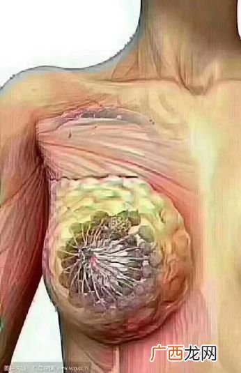 乳腺结节怎么造成的,乳腺硬块是怎么回事？